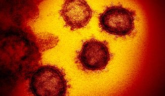 This undated electron microscope image made available by the U.S. National Institutes of Health in February 2020 shows the Novel Coronavirus SARS-CoV-2. Also known as 2019-nCoV, the virus causes COVID-19. The sample was isolated from a patient in the U.S. On Tuesday, April 21, 2020, U.S. health regulators OK&#39;d the first coronavirus test that allows people to collect their own sample at home, a new approach that could help expand testing options in most states. The sample will still have to be shipped for processing back to LabCorp, which operates diagnostic labs throughout the U.S. (NIAID-RML via AP)