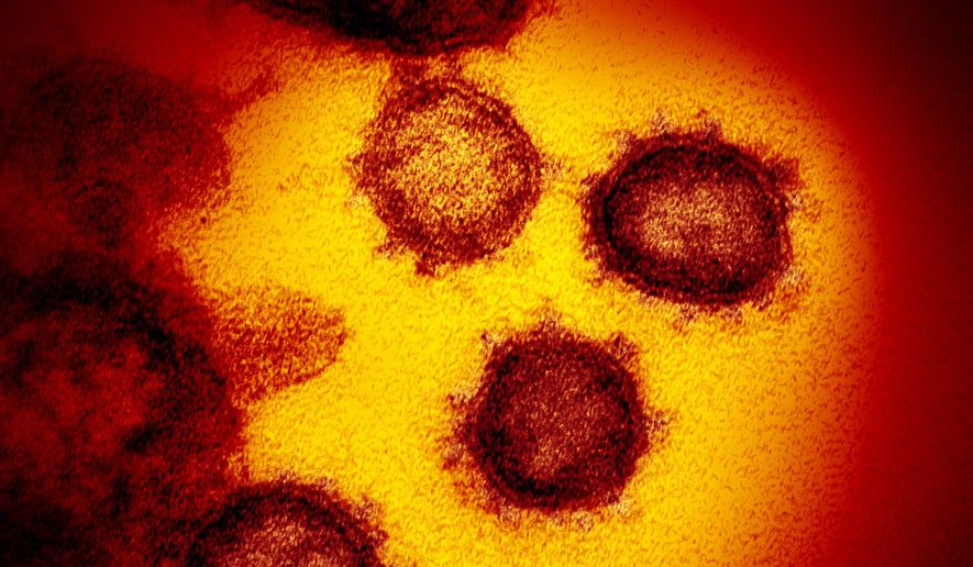 This undated electron microscope image made available by the U.S. National Institutes of Health in February 2020 shows the novel coronavirus, SARS-CoV-2, the virus that causes COVID-19. (NIAID-RML via AP) ** FILE **