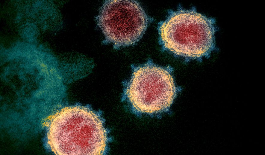 This undated electron microscope image made available by the U.S. National Institutes of Health in February 2020 shows the coronavirus that causes COVID-19. The sample was isolated from a patient in the U.S. (NIAID-RML via AP)
