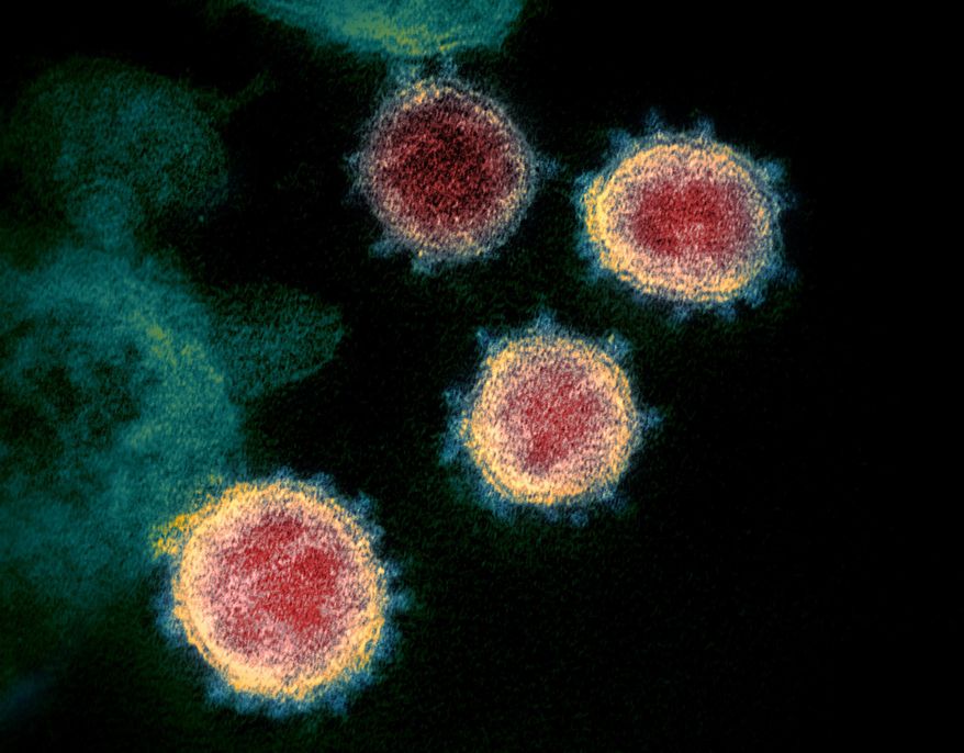 This undated electron microscope image made available by the U.S. National Institutes of Health in February 2020 shows the coronavirus that causes COVID-19. The sample was isolated from a patient in the U.S. (NIAID-RML via AP)