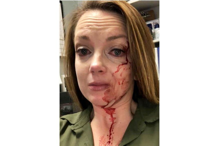This May 6, 2020 selfie by Samantha Clarke shows her bruised and bloodied face after she was assaulted by a shopper at the retail store she manages in Modesto, Calif. Despite the abuse and occasional threats, Clarke says she never expected to be sucker-punched and knocked to the floor by an angry shopper as happened earlier this month. (Samantha Clarke via AP)
