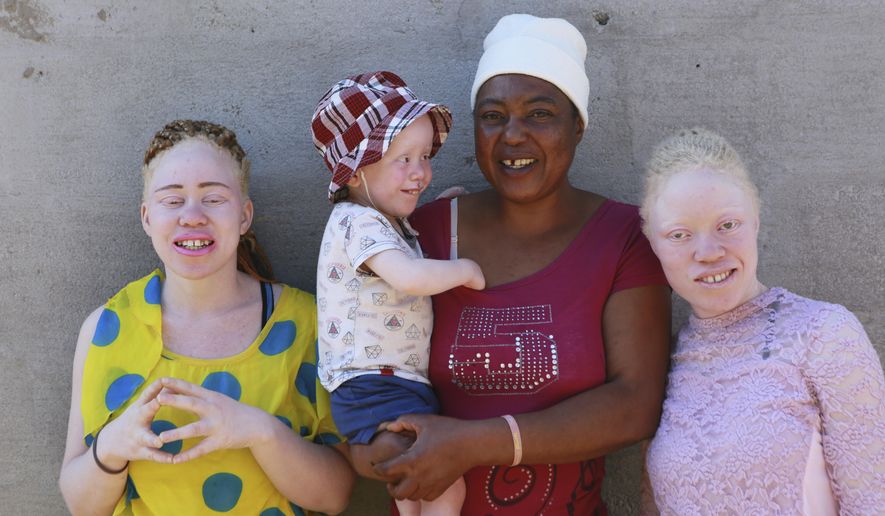 Joyce Muchenje,centre, poses for a photo with her three children, who all have albinism, outside their family home in Chitungwiza on the outskirts of Harare, in this Tuesday, June, 9, 2020. Muchenje used to provide for them by washing laundry and household cleaning for cross border traders at a busy border town before the lockdown, but now the border trade has stopped and Mutenje has run out of money to get the skin cream for her children. (AP Photo/Tsvangirayi Mukwazhi)