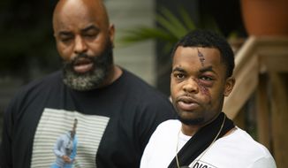 In this Tuesday, May 19, 2020 photo, DarQuan Jones, right, speaks during a press conference alongside his father, Daryl Jones Jr., in Des Moines, Iowa. Jones, 22, was assaulted by three white men in the early morning of May 16 in a racially motivated attack, resulting in five facial fractures and a broken wrist. Jones said there was an attempt to drown him in a nearby creek, and at least one perpetrator repeatedly used racial slurs. As of Friday, June 19, 2020,, one suspect has been arrested and one additional warrant issued for arrest. (Olivia Sun/The Des Moines Register via AP  )