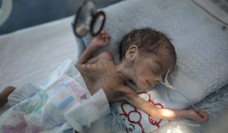 FILE - In this Nov. 23, 2019 file photo, a  malnourished newborn baby lies in an incubator at Al-Sabeen hospital in Sanaa, Yemen.   The U.N. children’s agency says that millions of Yemeni children could be pushed to “the brink of starvation” as the coronavirus pandemic sweeps across the war-torn Arab country amid a huge drop in humanitarian aid funding. UNICEF on Friday, June 26, 2020 released a new report, “Yemen five years on: Children, conflict and COVID-19.” (AP Photo/Hani Mohammed, File)