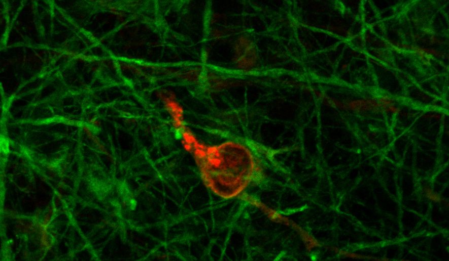Johns Hopkins University researchers say serious neurological problems can be caused by brain cells that have been infected by the coronavirus. (Dr. Lena Smirnova/CAAT)
