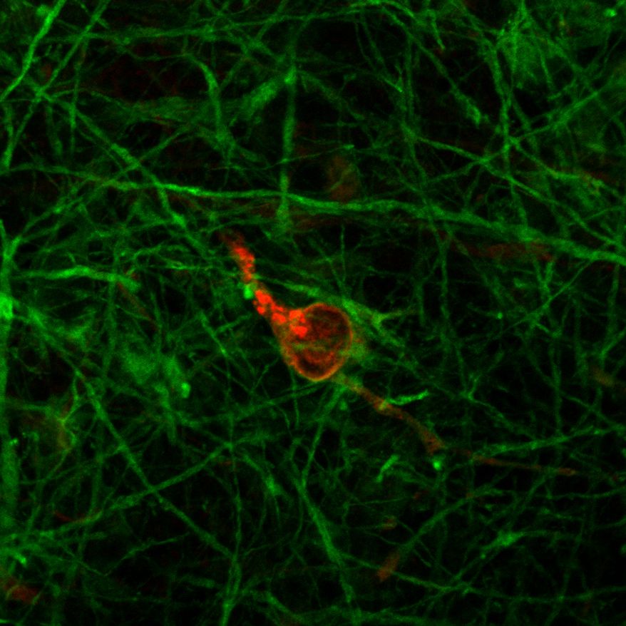 Johns Hopkins University researchers say serious neurological problems can be caused by brain cells that have been infected by the coronavirus. (Dr. Lena Smirnova/CAAT)