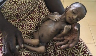 One-month old Haboue Solange Boue, awaiting medical care for severe malnutrition, is held by her mother, Danssanin Lanizou, 30, at the feeding center of the main hospital in the town of Hounde, Tuy Province, in southwestern Burkina Faso on Thursday, June 11, 2020. With the markets closed because of coronavirus restrictions, her family sold fewer vegetables. Lanizou is too malnourished to nurse her. (AP Photo/Sam Mednick)