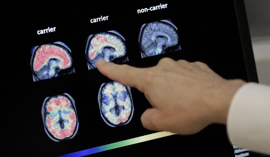 In this Aug. 14, 2018, photo, a doctor looks at PET brain scans in Phoenix. (AP Photo/Matt York) **FILE**