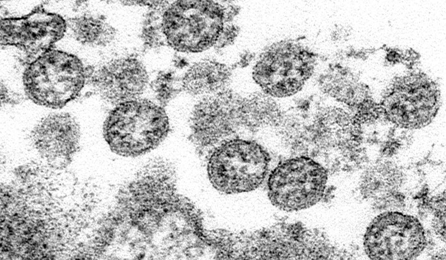 This 2020 electron microscope made available by the U.S. Centers for Disease Control and Prevention image shows the spherical coronavirus particles from the first U.S. case of COVID-19. Released by the CDC on Friday, July 31, 2020, a Georgia summer camp hit by a coronavirus outbreak took many precautions, but didn’t make campers wear masks and put too many children in the same cabin, according to a government report released Friday. (C.S. Goldsmith, A. Tamin/CDC via AP)