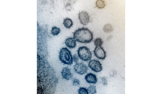 FILE - This undated electron microscope file image made available by the U.S. National Institutes of Health in February 2020 shows the Novel Coronavirus SARS-CoV-2. Also known as 2019-nCoV, the virus causes COVID-19. A Chinese mining company in Papua New Guinea claims to have immunized employees against COVID-19 in an apparent vaccination trial, a newspaper reported on Friday., Aug. 21, 2020.  A document on company letterhead entitled “Vaccination Statement” said 48 Chinese employees “have been vaccinated with SARS-COV-2 vaccine” on Aug. 10. (NIAID-RML via AP, File)