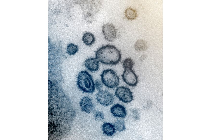 FILE - This undated electron microscope file image made available by the U.S. National Institutes of Health in February 2020 shows the Novel Coronavirus SARS-CoV-2. Also known as 2019-nCoV, the virus causes COVID-19. A Chinese mining company in Papua New Guinea claims to have immunized employees against COVID-19 in an apparent vaccination trial, a newspaper reported on Friday., Aug. 21, 2020.  A document on company letterhead entitled “Vaccination Statement” said 48 Chinese employees “have been vaccinated with SARS-COV-2 vaccine” on Aug. 10. (NIAID-RML via AP, File)