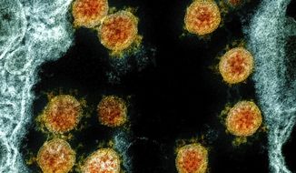 This electron microscope image made available and color-enhanced by the National Institute of Allergy and Infectious Diseases Integrated Research Facility in Fort Detrick, Md., in 2020, shows Novel Coronavirus SARS-CoV-2 virus particles, orange, isolated from a patient. (NIAID/National Institutes of Health via AP)
