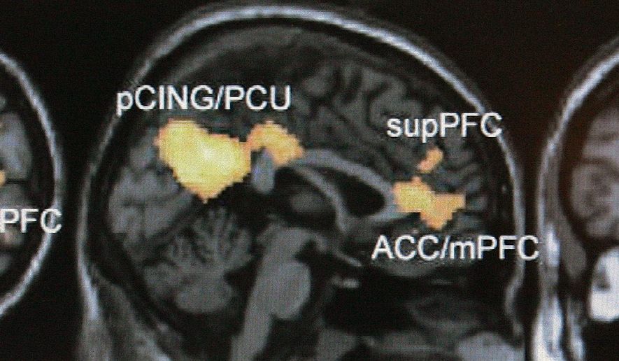 FILE - This Jan. 30, 2006 file photo shows a functional magnetic resonance imaging scan on a computer screen at an Emory University lab in Atlanta. Using large magnets, the scans detect where oxygenated blood flows, allowing scientists to indirectly measure brain activity. Researchers are becoming increasingly critical of some brain scan studies that purport to show exactly how our minds shape our behavior. (AP Photo/Ric Feld, File)