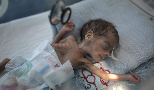 FILE - In this Nov. 23, 2019 file photo, a malnourished newborn baby lies in an incubator at Al-Sabeen hospital in Sanaa, Yemen. The United Nations Children’s Fund on Monday, Dec. 7, 2020, launched a global appeal for a record $2.5 billion of emergency assistance for the Middle East and North Africa, saying the funds were necessary to respond to the needs of millions of children across a region hit hard by conflict, natural disaster and the coronavirus crisis. (AP Photo/Hani Mohammed, File)