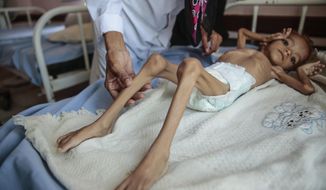FILE - In this Oct. 1, 2018, file photo, a severely malnourished boy rests on a hospital bed at the Aslam Health Center in Hajjah, Yemen. A leading aid organization on Monday, Jan. 11, 2021 warned that U.S. Secretary of State Mike Pompeo&#39;s move to designate Yemen’s Iran-backed Houthi rebels as a “foreign terrorist organization” would deal another “devastating blow&amp;quot; to the impoverished and war-torn nation. (AP Photo/Hani Mohammed, File)