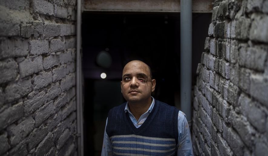 Muhammad Nasir Khan, who was shot by a Hindu mob during the February 2020 communal riots, poses for a photograph inside his home in North Ghonda, one of the worst riot affected neighborhood, in New Delhi, India, Friday, Feb. 19, 2021. As the first anniversary of bloody communal riots that convulsed the Indian capital approaches, Muslim victims are still shaken and struggling to make sense of their struggle to seek justice. (AP Photo/Altaf Qadri)