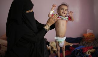 In this Nov. 23, 2019, file photo, a woman holds her malnourished boy at a feeding center at the Al-Sabeen Hospital in Sanaa, Yemen. After a visit to Yemen the World Food Program&#39;s executive director, David Beasley, warned that his underfunded organization may be forced to seek hundreds of millions of dollars in private donations in a desperate bid to stave off widespread famine in the coming months. Beasley told The Associated Press in an interview Wednesday, March 10, 2021, that conditions in war-wrecked Yemen are “hell.”  (AP Photo/Hani Mohammed, File)