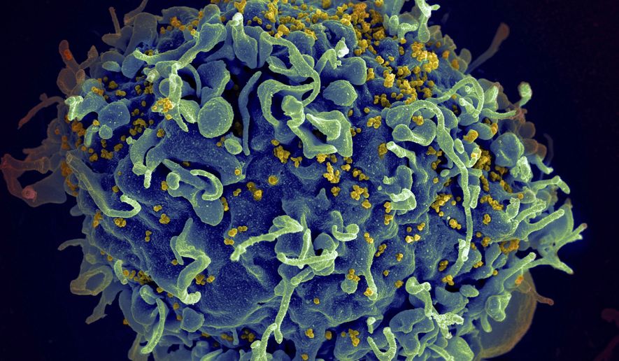 FILE - This colorized electron microscope image made available by the U.S. National Institutes of Health shows a human T cell, indicated in blue, under attack by HIV, in yellow, the virus that causes AIDS. In a study released in the journal Nature on Thursday, April 28, 2022, climate change will result in thousands of new viruses spread among animal species by 2070, which is likely to increase the risk of emerging infectious diseases jumping from animals to humans. (Seth Pincus, Elizabeth Fischer, Austin Athman/National Institute of Allergy and Infectious Diseases/NIH via AP)
