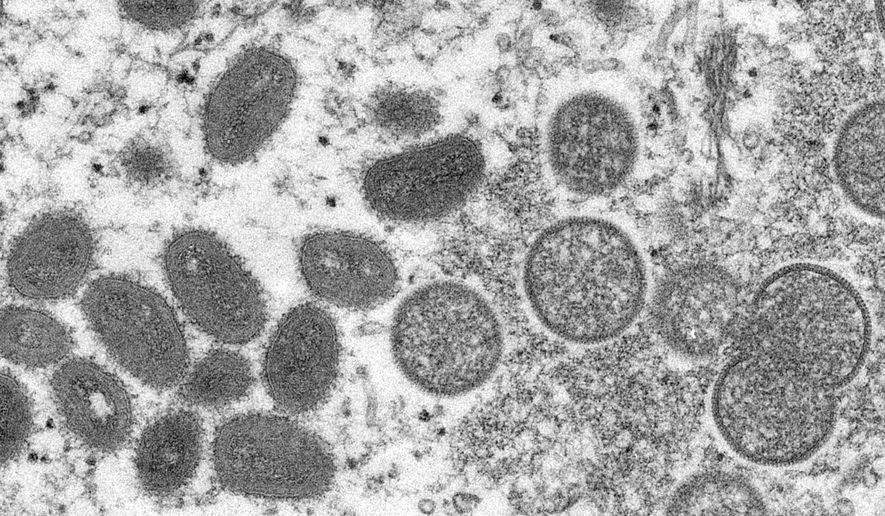 This 2003 electron microscope image made available by the Centers for Disease Control and Prevention shows mature, oval-shaped monkeypox virions, left, and spherical immature virions, right, obtained from a sample of human skin associated with the 2003 prairie dog outbreak. On Wednesday, May 18, 2022, Portuguese health authorities confirmed five cases of monkeypox in young men, marking an unusual outbreak in Europe of a disease typically limited to Africa. (Cynthia S. Goldsmith, Russell Regner/CDC via AP) ** FILE **