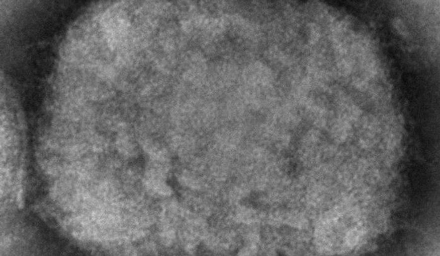 This 2003 electron microscope image made available by the Centers for Disease Control and Prevention shows a monkeypox virion, obtained from a sample associated with the 2003 prairie dog outbreak. On Wednesday, May 18, 2022, Massachusetts has reported a rare case of monkeypox in a man who recently had traveled to Canada, and investigators are looking into whether it is connected to recent cases in Europe. (Cynthia S. Goldsmith, Russell Regner/CDC via AP)