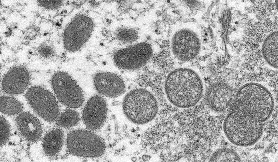 This 2003 electron microscope image made available by the Centers for Disease Control and Prevention shows mature, oval-shaped monkeypox virions, left, and spherical immature virions, right, obtained from a sample of human skin associated with the 2003 prairie dog outbreak. A leading doctor who chairs a World Health Organization expert group described the unprecedented outbreak of the rare disease monkeypox in developed countries as &amp;quot;a random event&amp;quot; that might be explained by risky sexual behavior at two recent mass events in Europe. (Cynthia S. Goldsmith, Russell Regner/CDC via AP, File)