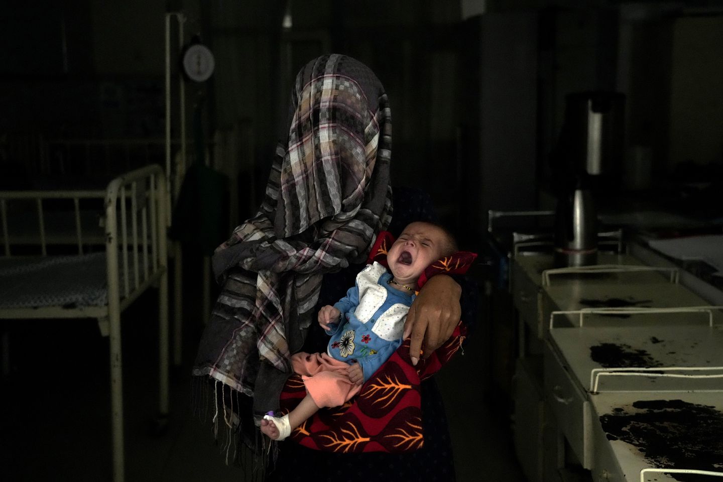 1,1 milyon Afgan çocuk ciddi yetersiz beslenmeyle karşı karşıya kalabilir