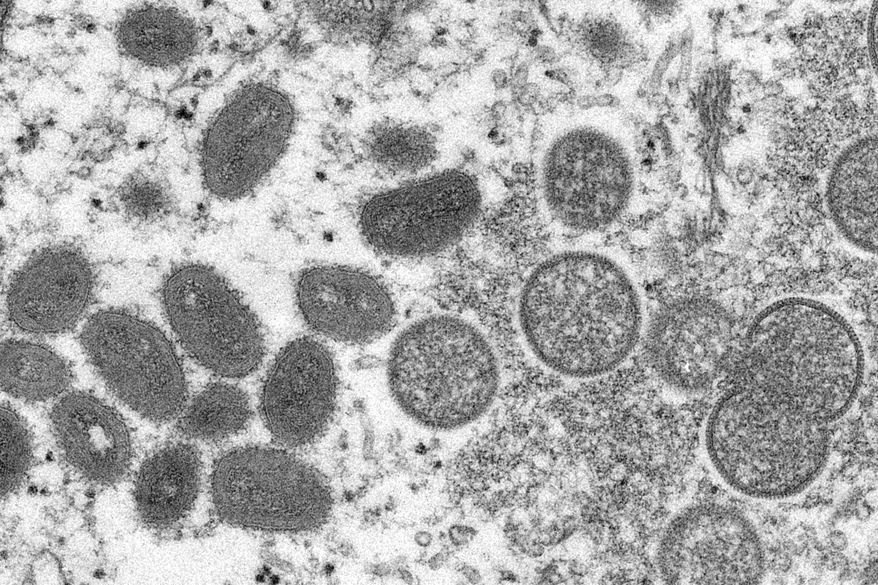 This 2003 electron microscope image made available by the Centers for Disease Control and Prevention shows mature, oval-shaped monkeypox virions, left, and spherical immature virions, right, obtained from a sample of human skin associated with the 2003 prairie dog outbreak. Health authorities in Africa said Thursday, June 30, 2022 they are treating the expanding monkeypox outbreak there as an emergency and are calling on rich countries to share the world's limited supply of vaccines in an effort to avoid the glaring equity problems seen during the COVID-19 pandemic. (Cynthia S. Goldsmith, Russell Regner/CDC via AP, File)