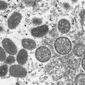 This 2003 electron microscope image made available by the Centers for Disease Control and Prevention shows mature, oval-shaped monkeypox virions, left, and spherical immature virions, right, obtained from a sample of human skin associated with the 2003 prairie dog outbreak. (Cynthia S. Goldsmith, Russell Regner/CDC via AP, File)