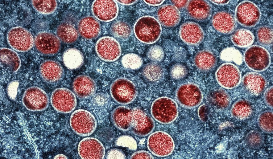 This image provided by the National Institute of Allergy and Infectious Diseases (NIAID) shows a colorized transmission electron micrograph of monkeypox particles (red) found within an infected cell (blue), cultured in the laboratory that was captured and color-enhanced at the NIAID Integrated Research Facility (IRF) in Fort Detrick, Md. On Friday, Aug. 12, 2022, The Associated Press reported on stories circulating online incorrectly claiming that monkeypox hasn&#39;t been detected in Georgia drinking water. The July 26 Atlanta-area news broadcast broadcast is being mischaracterized online to push the false claim that monkeypox has been found in residents’ tap water.  (NIAID via AP)