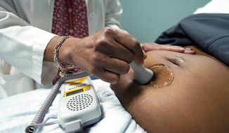 A doctor uses a hand-held Doppler probe on a pregnant woman to measure the heartbeat of the fetus on Dec. 17, 2021, in Jackson, Miss. COVID-19 drove a dramatic increase in the number of women who died from pregnancy or childbirth complications in the U.S. last year, a crisis that has disproportionately claimed Black and Hispanic women as victims, according to a report released Wednesday, Oct. 19, 2022. (AP Photo/Rogelio V. Solis, File)