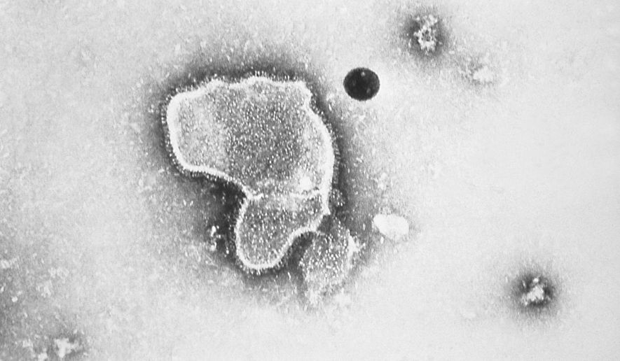 This 1981 photo provided by the Centers for Disease Control and Prevention (CDC) shows an electron micrograph of Respiratory Syncytial Virus, also known as RSV. (CDC via AP, File) **FILE**