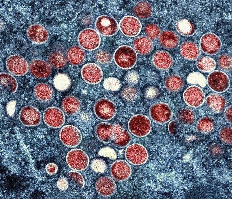 This image provided by the National Institute of Allergy and Infectious Diseases (NIAID) shows a colorized transmission electron micrograph of monkeypox particles (red) found within an infected cell (blue), cultured in the laboratory that was captured and color-enhanced at the NIAID Integrated Research Facility (IRF) in Fort Detrick, Md. The World Health Organization has renamed monkeypox as mpox, citing concerns the original name of the decades-old animal disease could be construed as discriminatory and racist. (NIAID via AP, File)