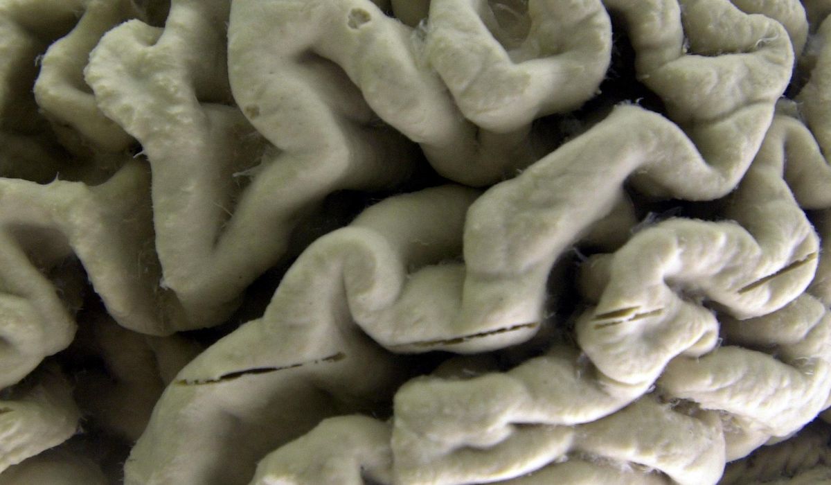 NextImg:Study links good sleep to reduced risk of Alzheimer’s disease