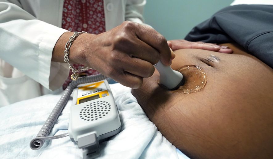 A doctor uses a hand-held Doppler probe on a pregnant woman to measure the heartbeat of the fetus on Dec. 17, 2021, in Jackson, Miss. (AP Photo/Rogelio V. Solis) **FILE**