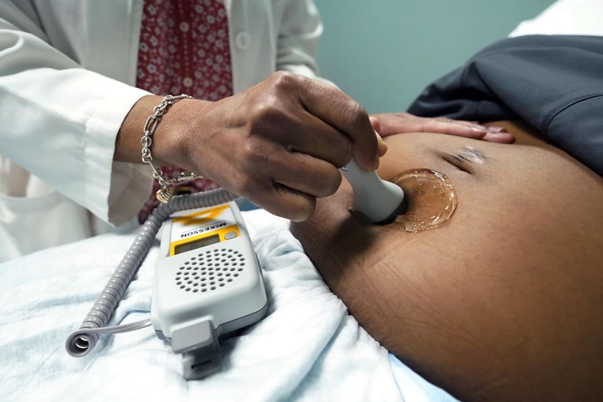 A doctor uses a hand-held Doppler probe on a pregnant woman to measure the heartbeat of the fetus on Dec. 17, 2021, in Jackson, Miss. (AP Photo/Rogelio V. Solis) **FILE**