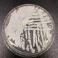 This undated photo made available by the Centers for Disease Control and Prevention shows a strain of Candida auris cultured in a petri dish at a CDC laboratory. In a CDC paper published by the Annals of Internal Medicine on Monday, March 20, 2023, U.S. cases of the dangerous fungus tripled over just three years, and more than half of states have now reported it. (Shawn Lockhart/Centers for Disease Control and Prevention via AP, File)