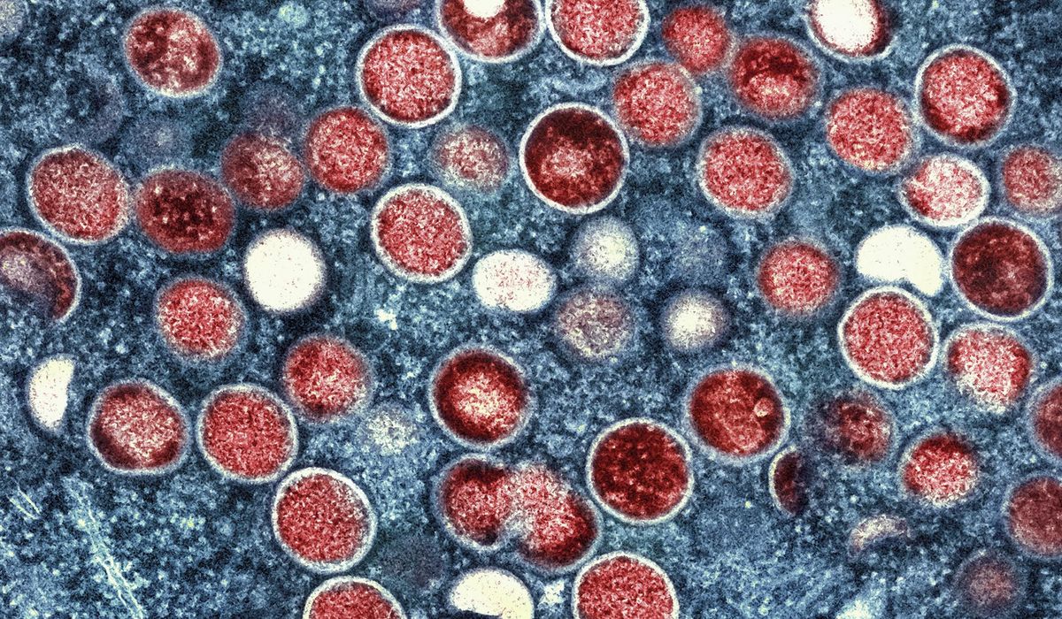 NextImg:Mpox is down, but U.S. cities could be at risk for summertime outbreaks