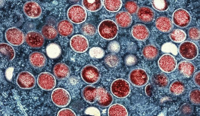 This colorized electron microscope image provided by the National Institute of Allergy and Infectious Diseases shows mpox particles, red, found within an infected cell, blue, cultured in a laboratory in Fort Detrick, Md. A study released by the U.S. Centers for Disease Control and Prevention on Thursday, May 25, 2023, suggests dozens of U.S. cities are at risk for mpox outbreaks this summer. Health officials say they are working to prevent the scale of infections that surprised the nation the previous summer. (NIAID via AP, File)