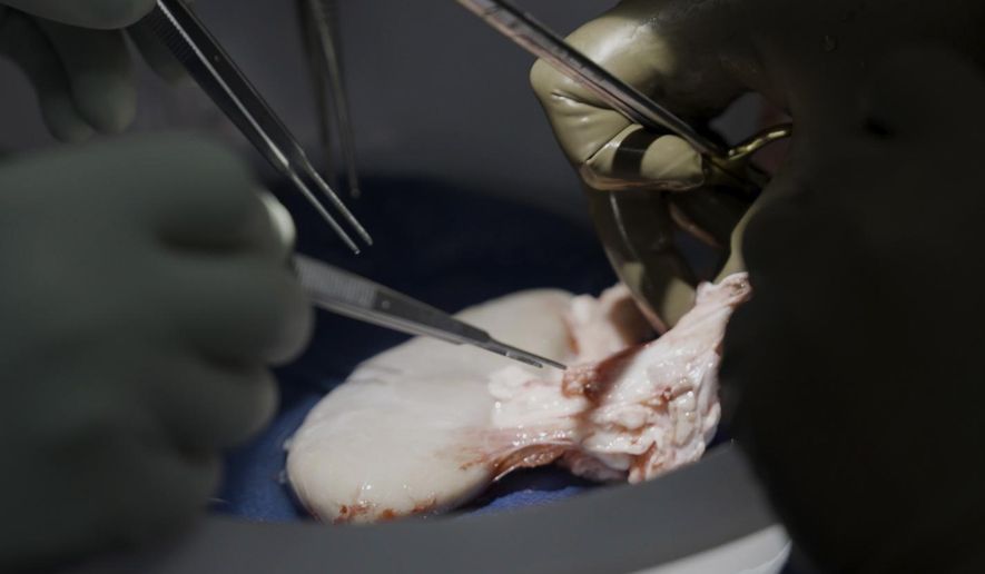 Surgeons at NYU Langone Health prepare to transplant a pig&#x27;s kidney into a brain-dead man in New York on July 14, 2023. Researchers around the country are racing to learn how to use animal organs to save human lives. (AP Photo/Shelby Lum)