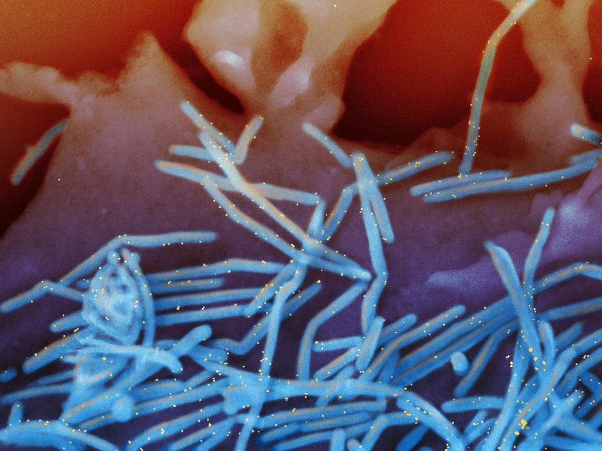This electron microscope image provided by the National Institutes of Health shows human respiratory syncytial virus (RSV) virions, colorized blue, and anti-RSV F protein/gold antibodies, colorized yellow, shedding from the surface of human lung cells. On Thursday, Feb. 29, 2024, health officials said they are investigating whether there's a link between two new RSV vaccines and cases of Guillain-Barre syndrome, a rare nervous system disorder, in older U.S. adults who got the shot. (National Institute of Allergy and Infectious Diseases, NIH via AP, File)