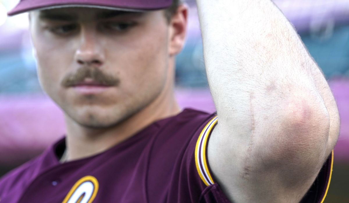NextImg:Hard-throwing teens draw scouts, scholarships. More and more, they may also need Tommy John surgery