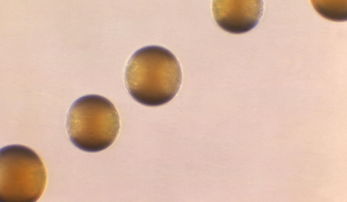 NextImg:Meningococcal disease, deaths rising, says CDC