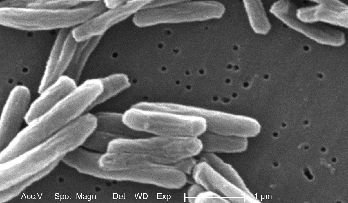 NextImg:Tuberculosis detected in migrant shelters in Chicago