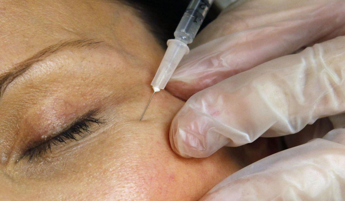 NextImg:Baby faces? Young Botox users raise concerns among health care specialists