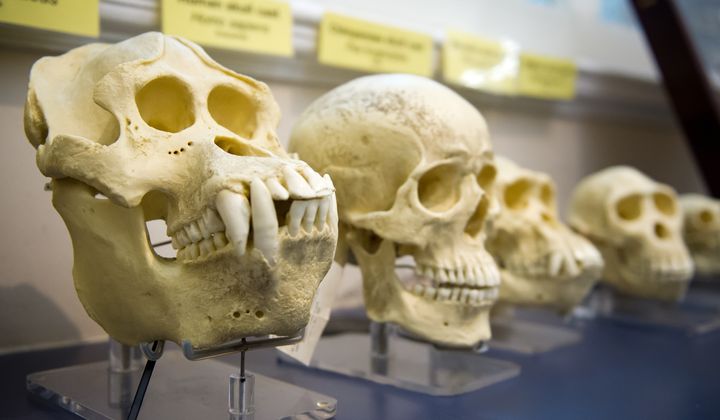 The Ulas family&#x27;s unique condition, observed in six of the 18 children, was initially thought to signal a potential reversal in the evolutionary process, a theory that sparked considerable debate and scrutiny within the scientific community. (File Photo credit: JuliusKielaitis via Shutterstock)