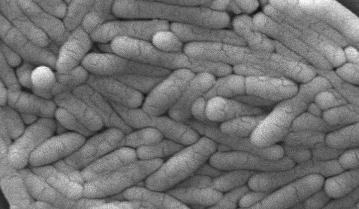 This 2009 electron microscope image provided by the Centers for Disease Control and Prevention shows a large group of Gram-negative Salmonella typhimurium bacteria that had been isolated from a pure culture. Poultry producers will be required to bring salmonella bacteria in certain chicken products to very low levels to help prevent food poisoning under a final rule issued Friday, April 26, 2024, by the U.S. Department of Agriculture. (Janice Haney Carr/CDC via AP) ** FILE **