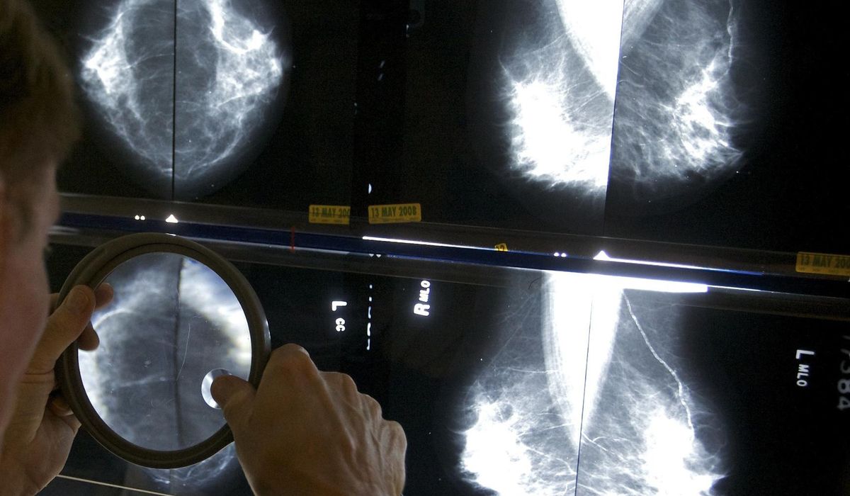 NextImg:Mammograms should start at 40 to address rising breast cancer rates at younger ages, panel says
