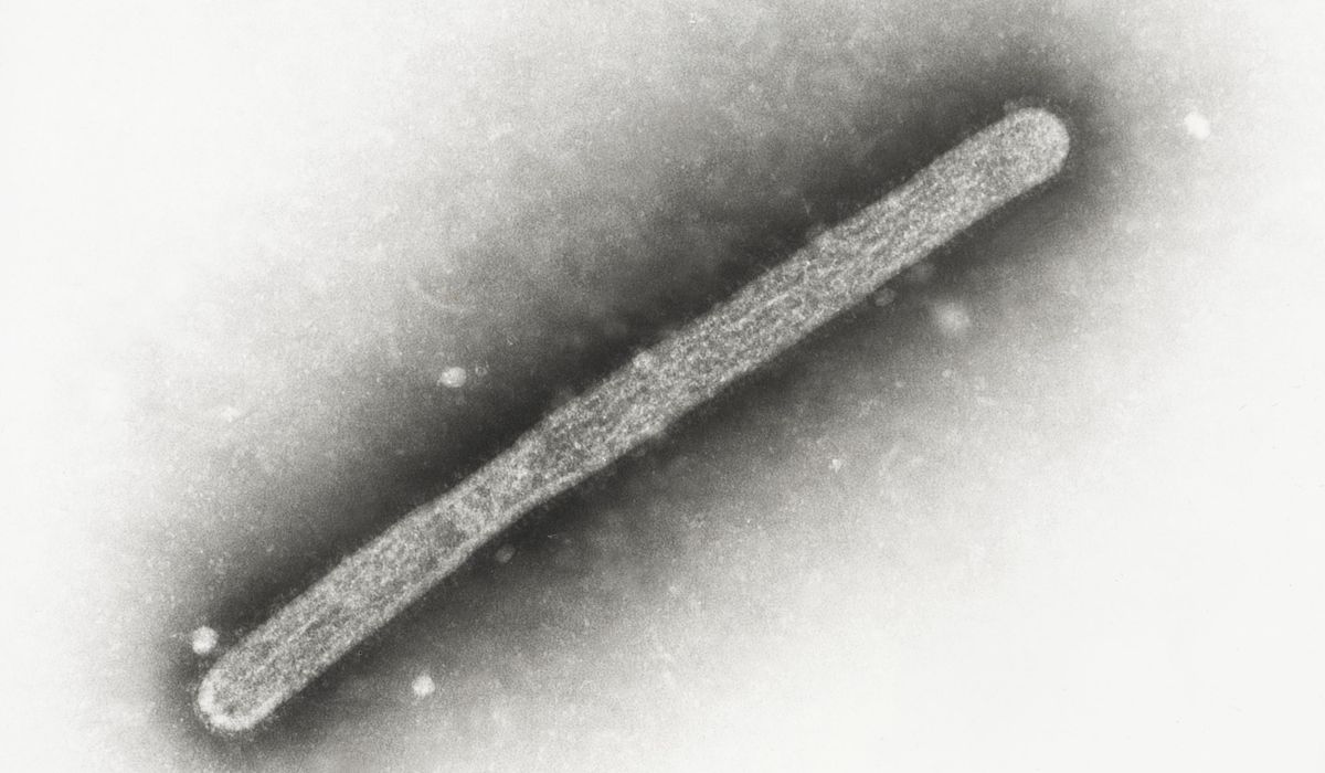 NextImg:Michigan farmworker diagnosed with bird flu, becoming 2nd U.S. case tied to dairy cows