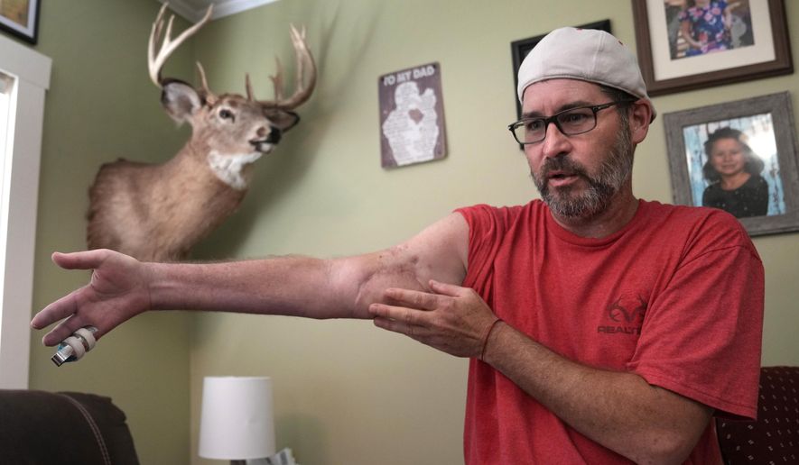 Ben Dyer talks about the injuries he suffered during the October 2023 mass shooting at Schemengee's Bar and Grille in Lewiston, Maine, at his home in Auburn, Maine, Thursday, June 6, 2024. Dyer, a lifelong hunter, survived being hit by several bullets, including one that shot off his right index finger. (AP Photo/Robert F. Bukaty)
