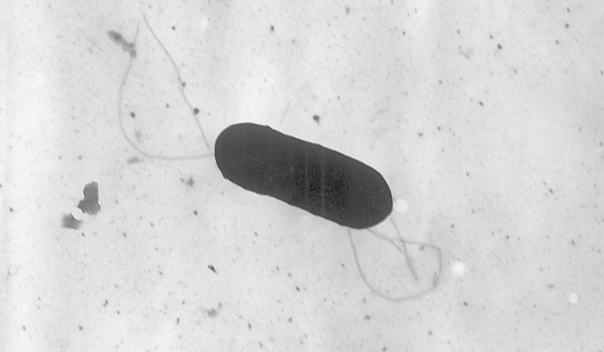 NextImg:CDC investigates listeria outbreak across the U.S., here’s how to handle deli meats